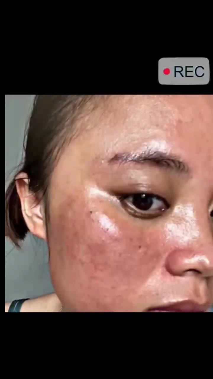 Dark Spots Removal Cream Facial Whitening Freckle Acne Mark Pigmentation Removal Melanin Skin Correction Brighten Care Products